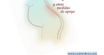 Analgesia epidural en el parto y otras medidas de apoyo